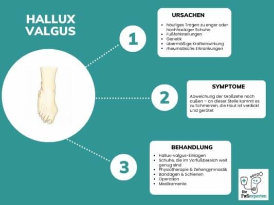 Infografik über den Hallux valgus und Informationen zu den Ursachen, Symptomen und Behandlung mit Einlagen 
