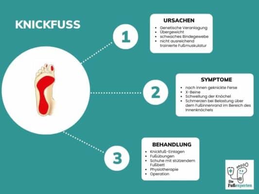 Infografik über den Knickfuß und Informationen zu den Ursachen, Symptomen und Behandlung mit Einlagen 
