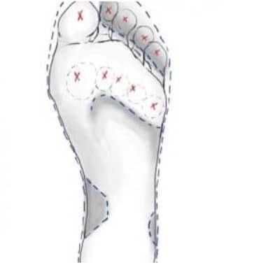 Abbildung der Mittelfußköpfchen und der Fußsohle