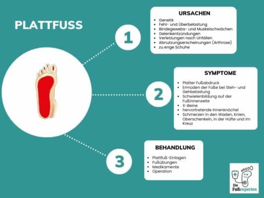 Infografik über den Plattfuß und Informationen zu den Ursachen, Symptomen und Behandlung mit Einlagen 