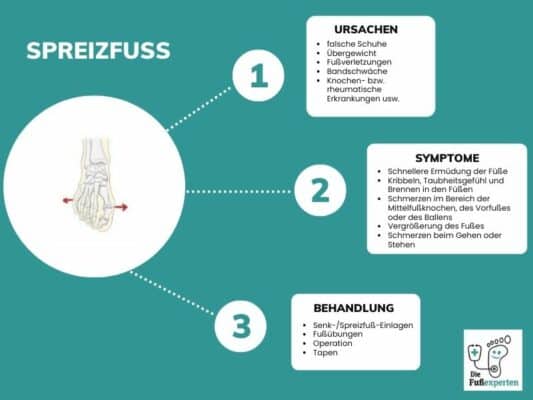 Infografik über den Senk-Spreizfuß und Informationen zu den Ursachen, Symptomen und Behandlung mit Einlagen