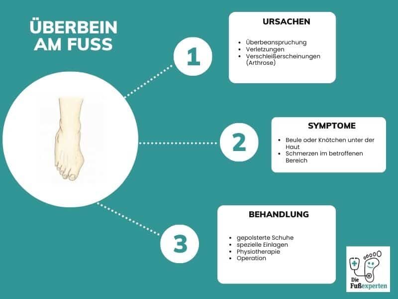 Eine Infografik zum Thema Überbein am Fuß, die die Ursachen, Symptome und Behandlungsmöglichkeiten aufzeigt