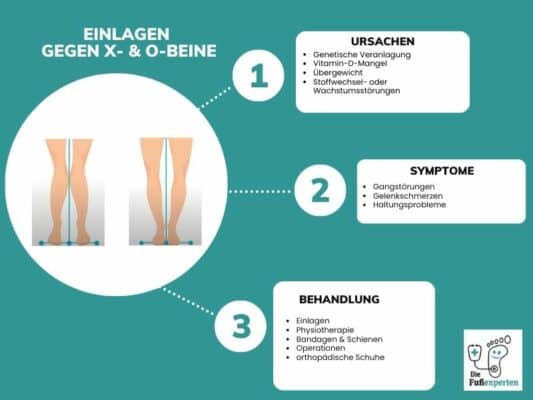 Infografik zum Thema X- und O-Beine, auf der verschiedene Informationen über Ursachen, Symptome und Behandlung mit Einlagen zu finden sind